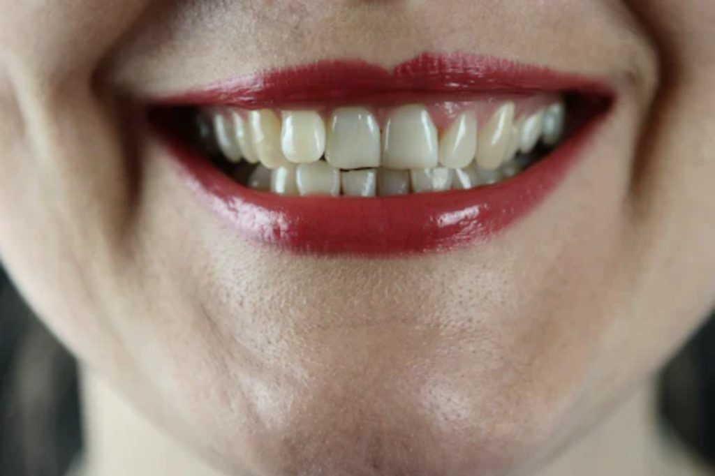 Belgische vrouw wordt op eerste dag ontslagen: Bedrijfsleider vind haar tanden lelijk!