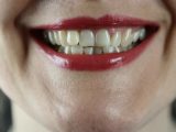 Belgische vrouw wordt op eerste dag ontslagen: Bedrijfsleider vind haar tanden lelijk!