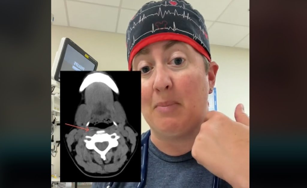 Dokter doet angstaanjagende ontdekking op scan bij jongetje (4) met oorpijn